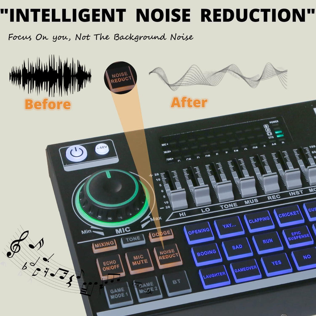 Podcast Equipment Bundle Kit with DJ Mixer and XLR Microphone F8047